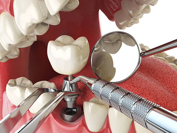 Best Tooth Infection Emergency Dentist  in Juneau, AK